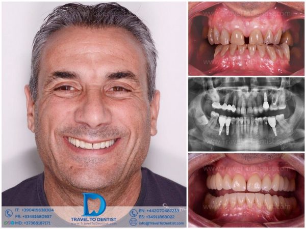 Caso de tratamiento dental 2